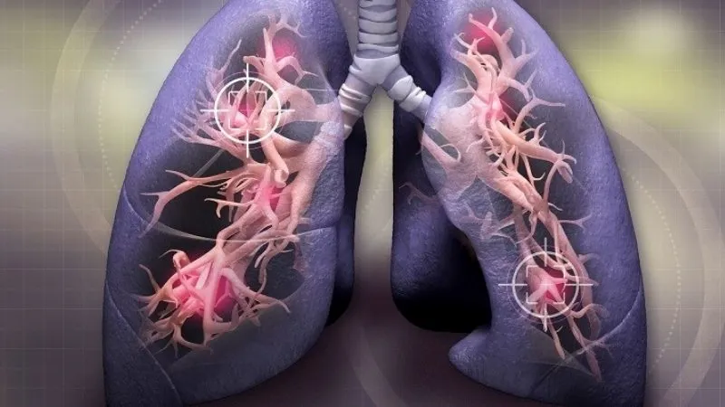 NHỮNG TÁC DỤNG & ĐIỀU CẦN BIẾT VỀ NGHỆ ĐEN 21 Image 42