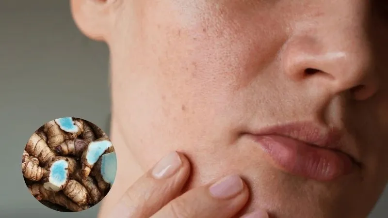 NHỮNG TÁC DỤNG & ĐIỀU CẦN BIẾT VỀ NGHỆ ĐEN 26 Image 45